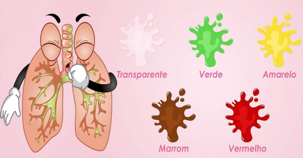 A cor do seu catarro pode indicar sérios problemas de saúde
